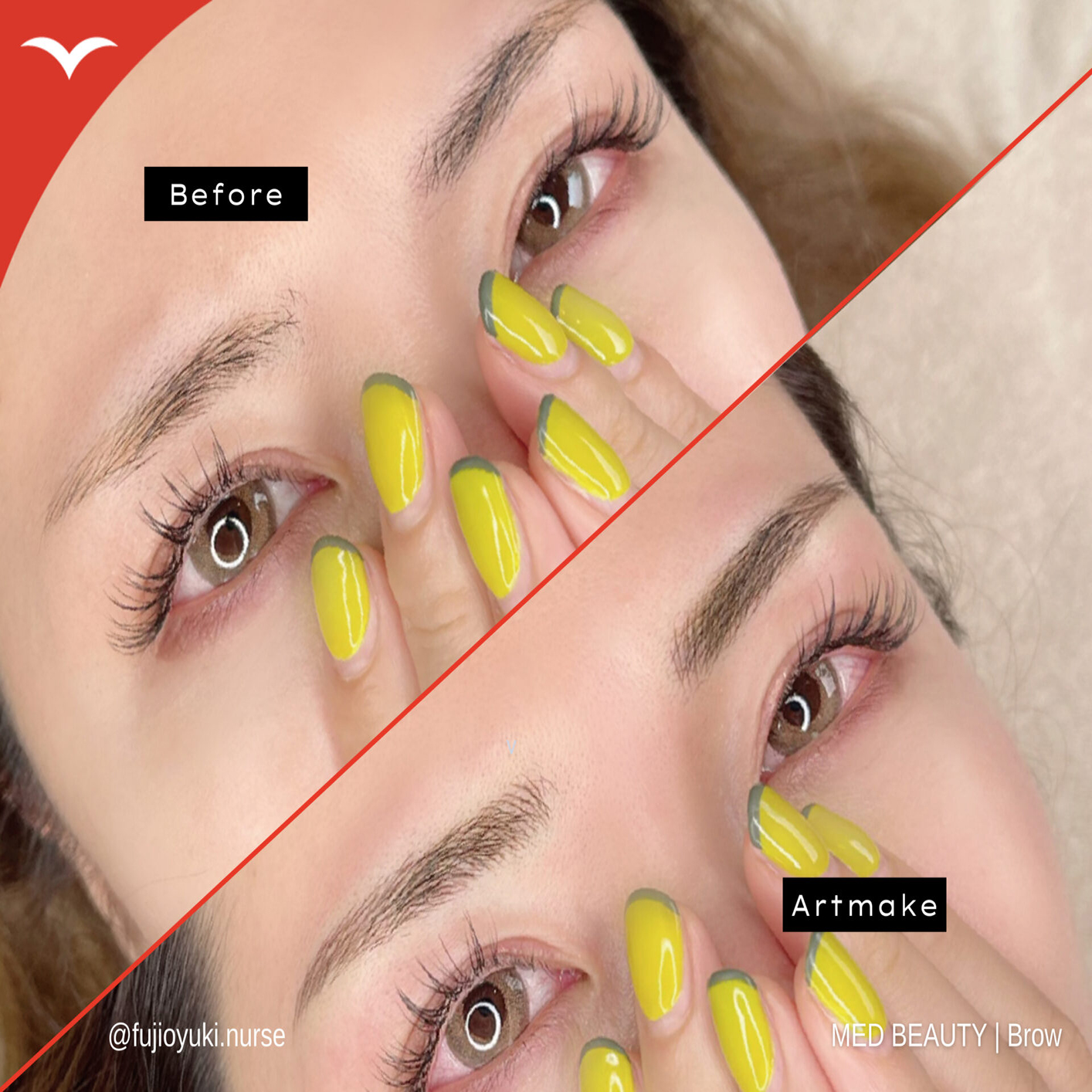 藤尾 症例写真3