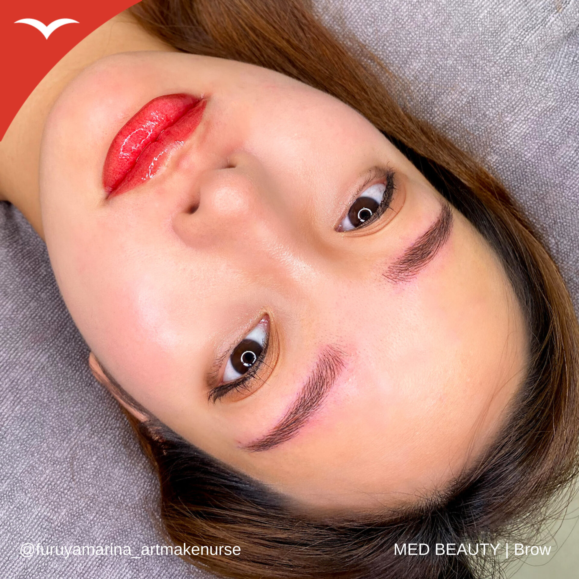 古谷真里奈 症例写真3