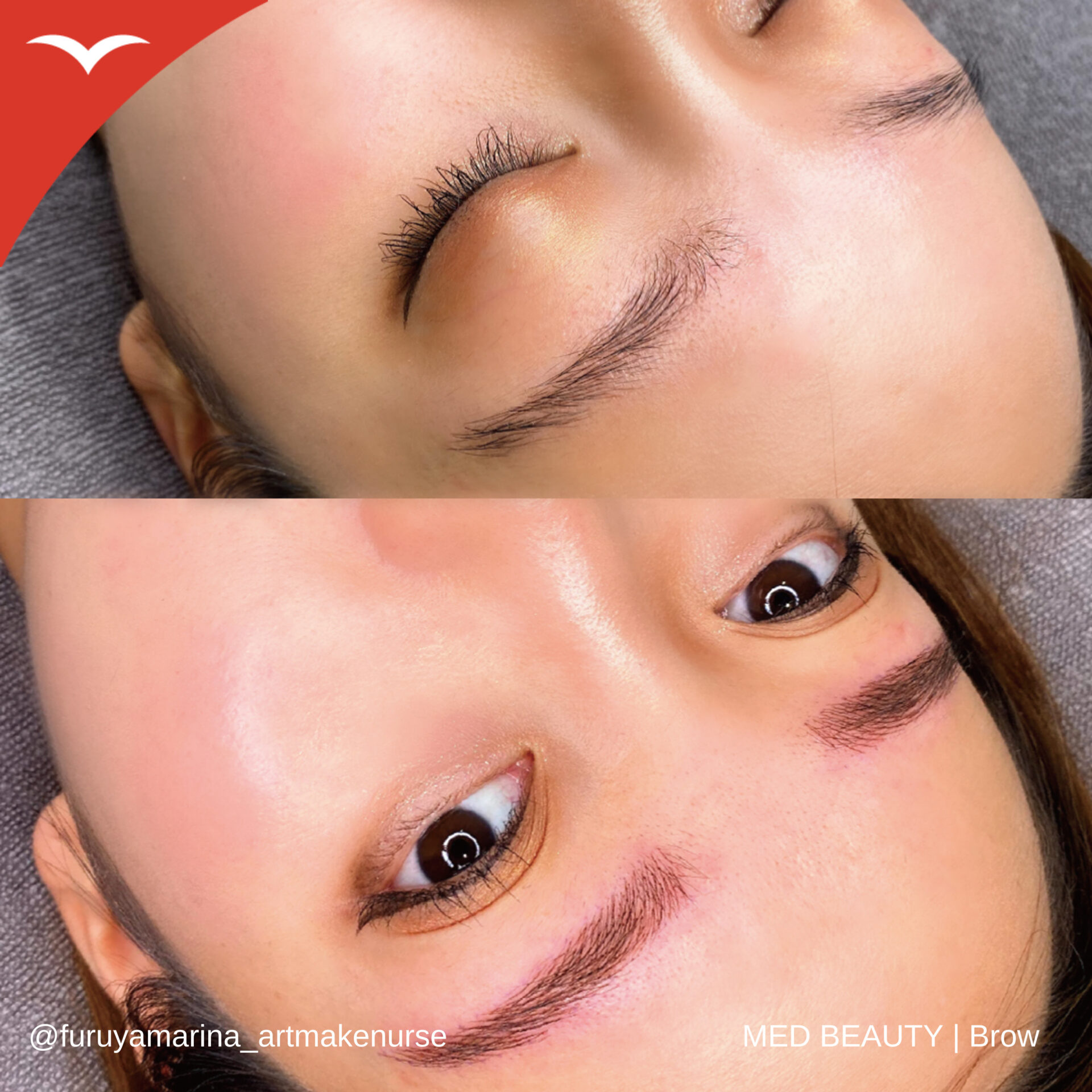 古谷真里奈 症例写真1