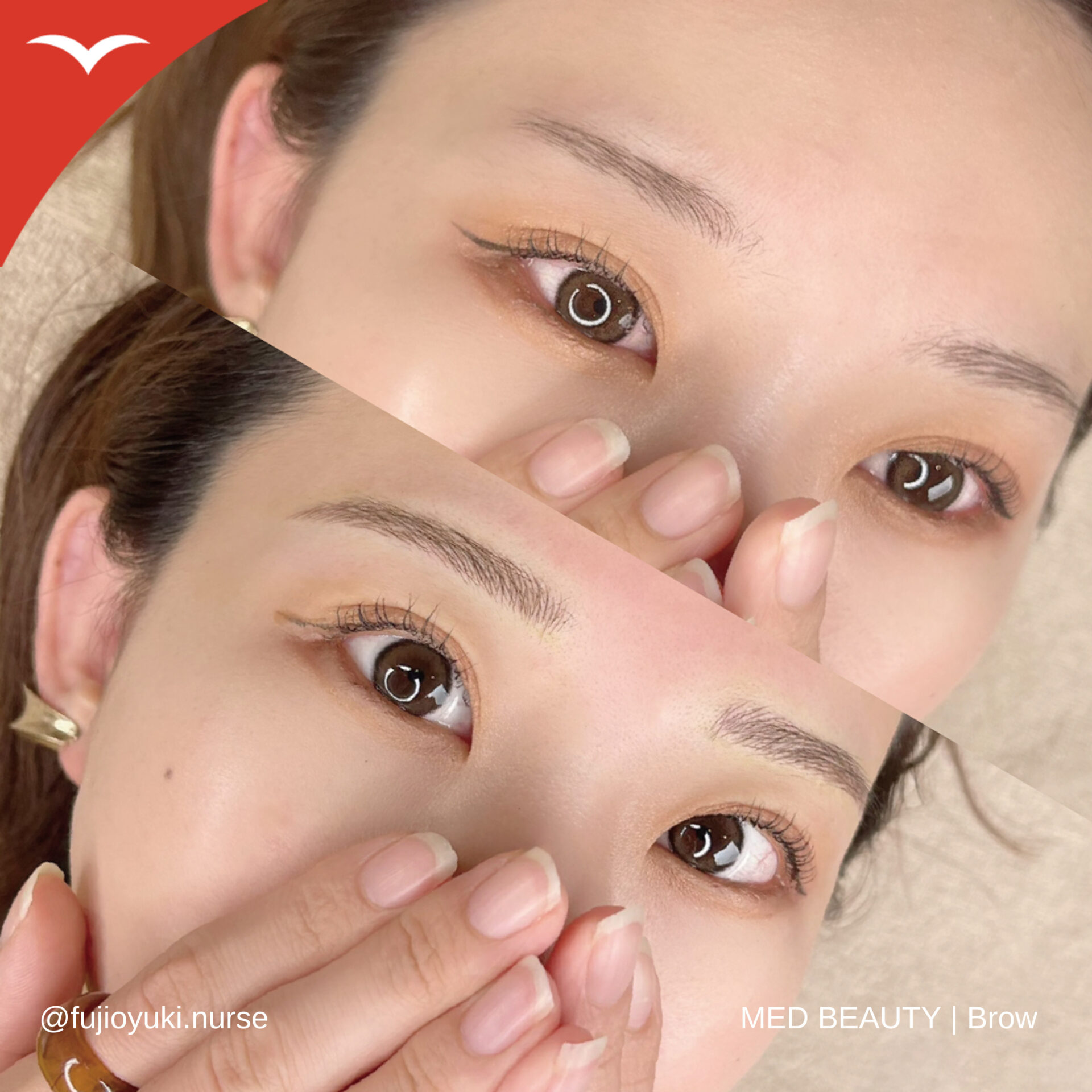 藤尾 症例写真1