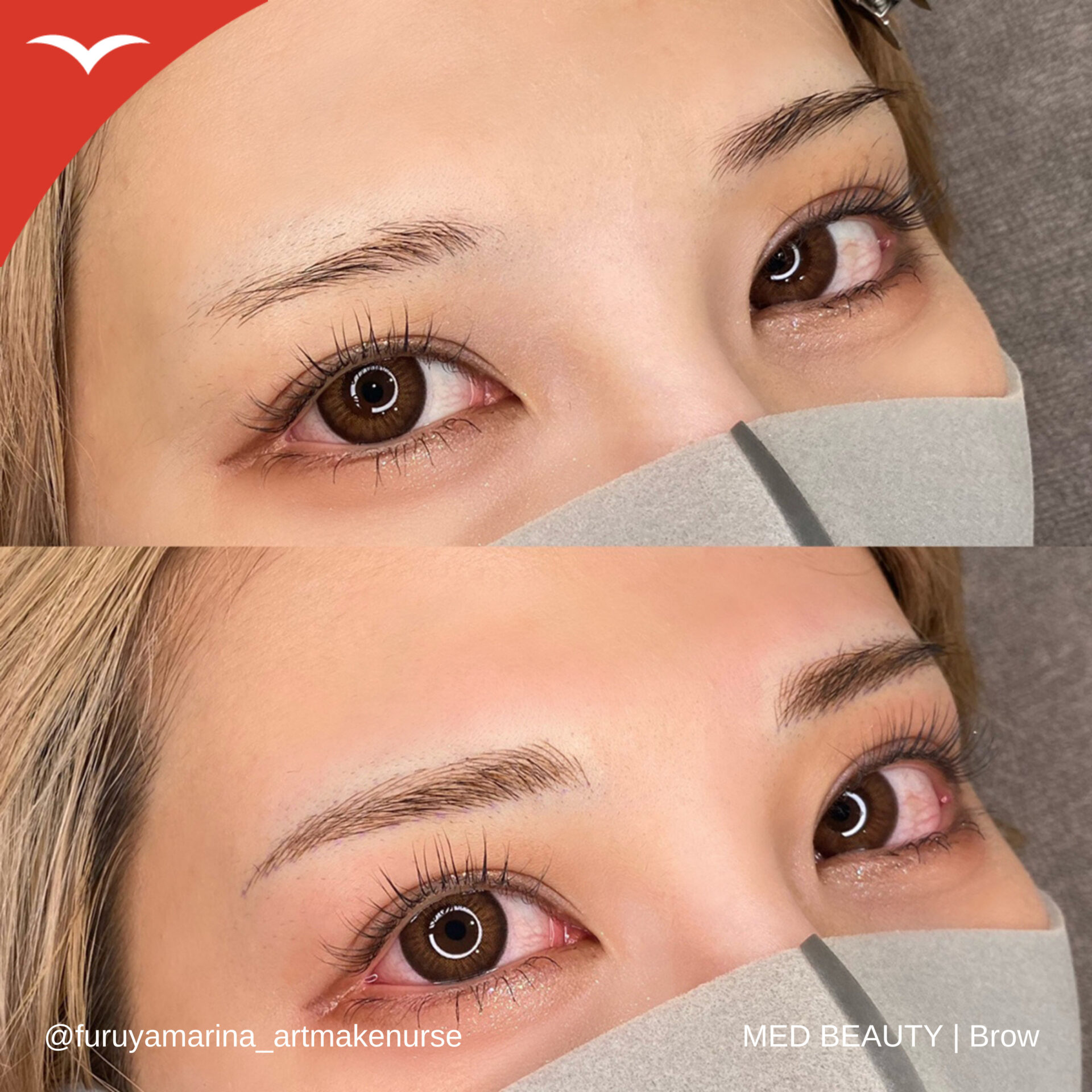 古谷真里奈 症例写真2