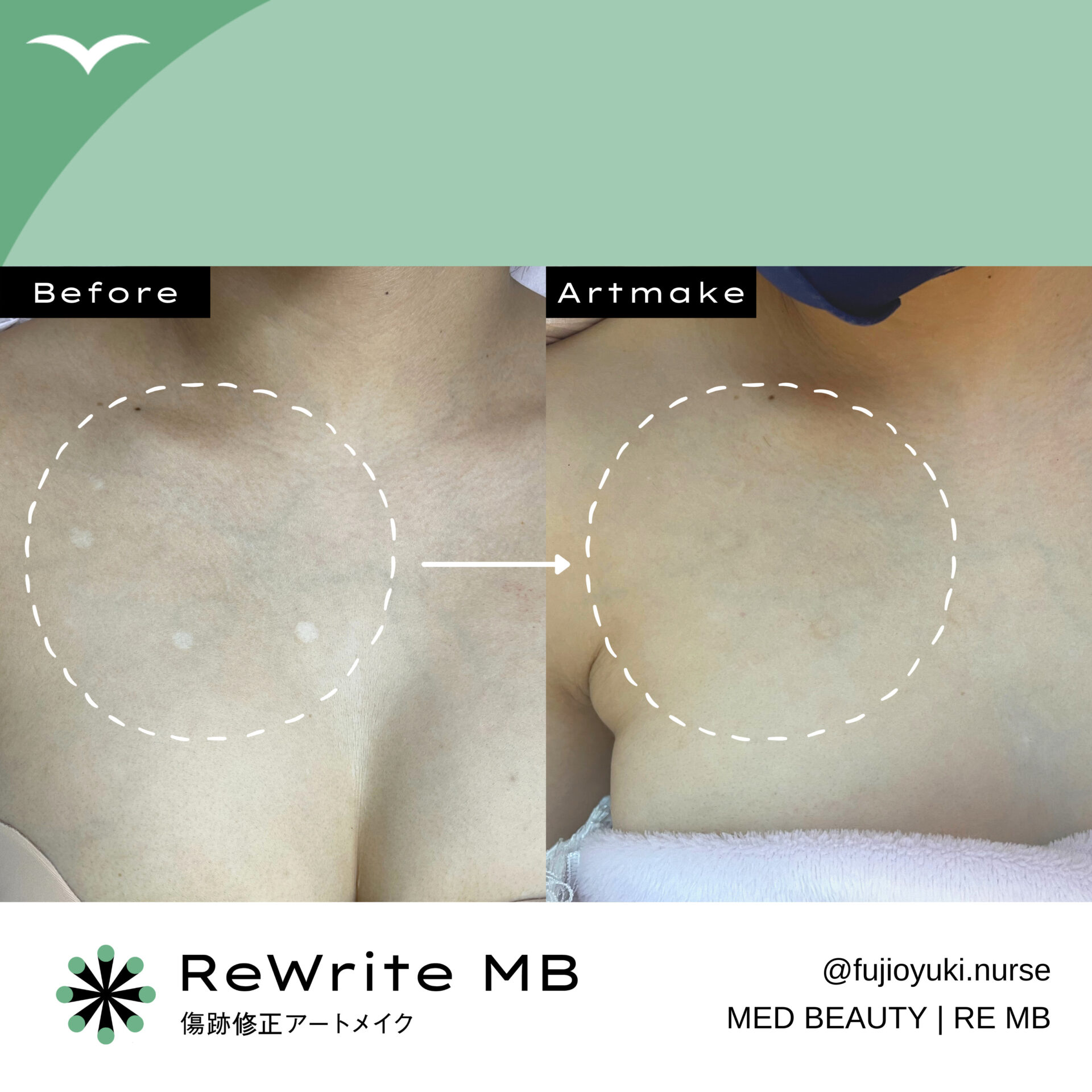 藤尾 症例写真2