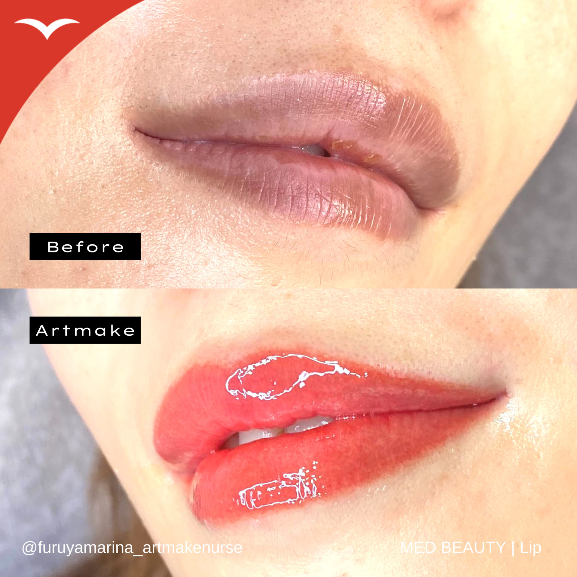 ビフォーアフター6