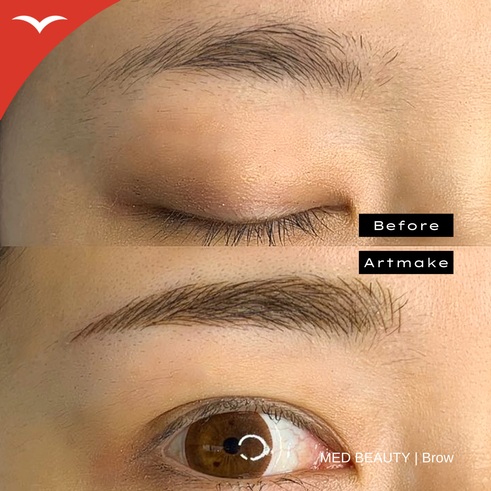 藤本綾 症例写真1