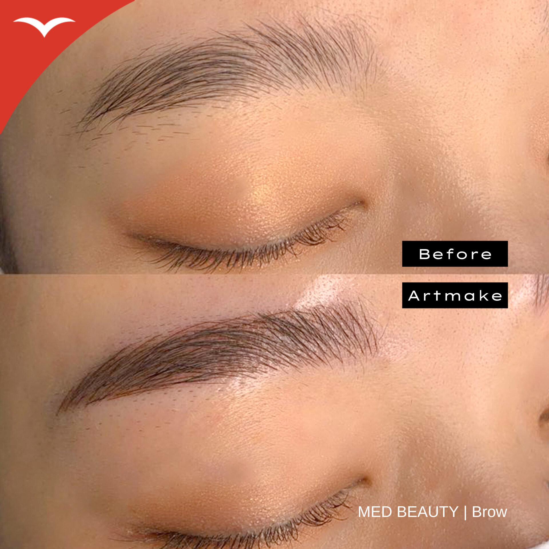 藤本綾 症例写真2