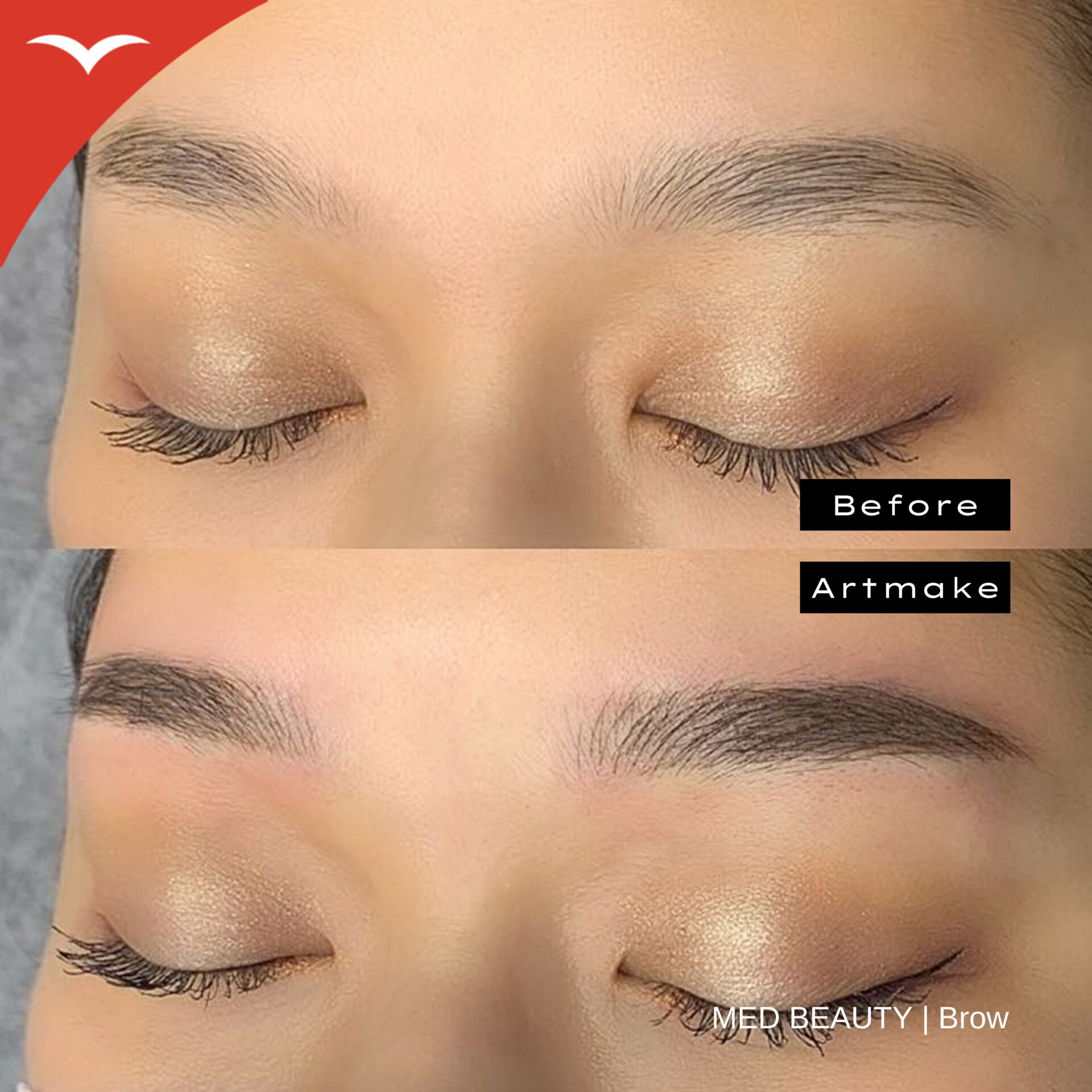 藤本綾 症例写真3