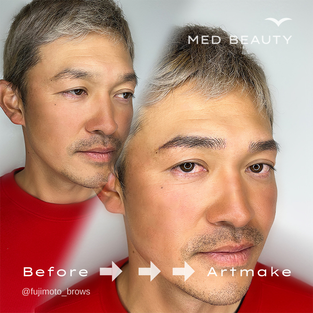 ビフォーアフター5