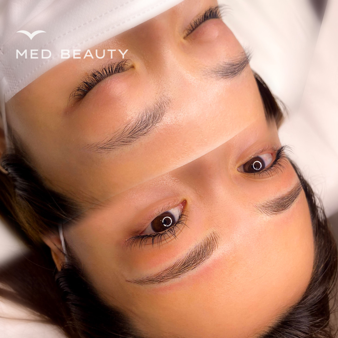 ビフォーアフター3