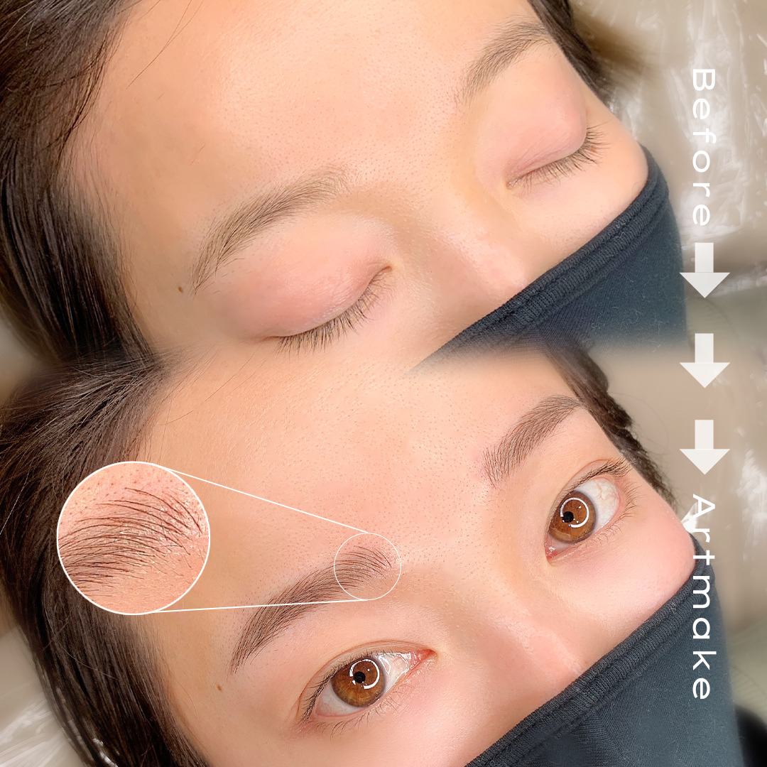 ビフォーアフター1