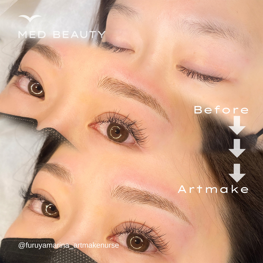 ビフォーアフター2