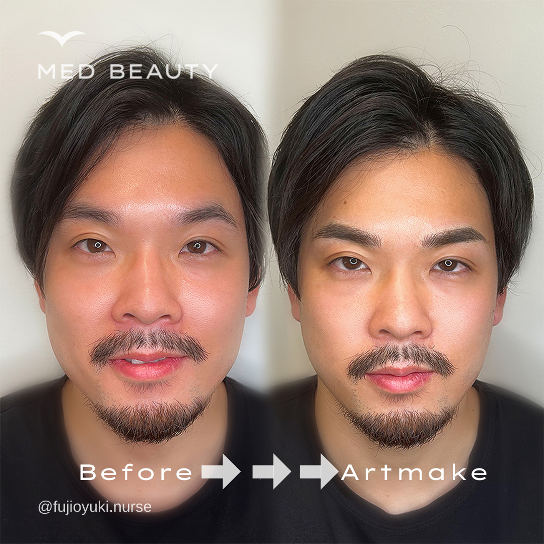 ビフォーアフター4